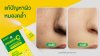 BIGO Power C+ ช่วยแก้ปัญหาผิวประเภทไหนได้บ้าง? BIGO Power C+ ช่วยแก้ปัญหาผิวประเภทไหนได้บ้าง?