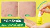 ทำไมวิตามินซีถึงเหมาะกับคนเป็นสิว? ลดรอยดำรอยแดง หลุมสิว ทำไมวิตามินซีถึงเหมาะกับคนเป็นสิว? ลดรอยดำรอยแดง หลุมสิว