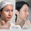 โปรแกรม Pico Laser