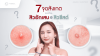 7 จุดที่ต้องสังเกต ระหว่างสิวอักเสบกับสิวซีสต์