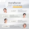 Ultherapy Prime