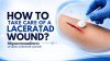 HOW TO TAKE CARE OF A LACERATAD WOUND
