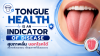 TONGUE HEALTH IS AN INDICATOR OF DISEASE