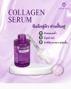 Serum Collagen