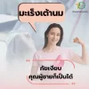 มะเร็งเต้านม มะเร็งเต้านม