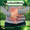 มะเร็งลำไส้ใหญ่ มะเร็งลำไส้ใหญ่
