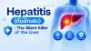Hepatitis, ตับอักเสบ, เซเปี้ยนซ์, sapiens Hepatitis, ตับอักเสบ, เซเปี้ยนซ์, sapiens