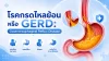 กรดไหลย้อน, เซเปี้ยนซ์, sapiens, อายุรกรรม กรดไหลย้อน, เซเปี้ยนซ์, sapiens, อายุรกรรม