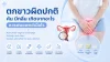 ตกขาว, ประจำเดือน, เซเปี้ยนซ์, sapiens,  อายุรกรรม
