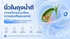 นิ่ว, ถุงน้ำดี,  เซเปี้ยนซ์, sapiens,  อายุรกรรม