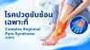 ปวด, ซับซ้อน, เซเปี้ยนซ์