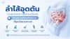 ลำใส้อุดตัน, เซเปี้ยนซ์, sapiens ลำใส้อุดตัน, เซเปี้ยนซ์, sapiens