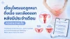 โพรงมดลูก, ประจำเดือน, เซเปี้ยนซ์, sapiens,  อายุรกรรม