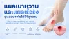 เบาหวาน, แผย, เรื้อรัง, เซเปี้ยนซ์, sapiens, อายุรกรรม เบาหวาน, แผย, เรื้อรัง, เซเปี้ยนซ์, sapiens, อายุรกรรม