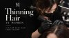  SMP for women with thinning hair and visible scalp SMP สำหรับผู้หญิงผมบาง ช่วยพรางหนังศีรษะ 
