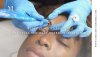 What Is Microblading