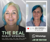 Restoring Vibrance Naturally: Jana Stanfield’s Deep Plane Facelift Story Restoring Vibrance Naturally: Jana Stanfield’s Deep Plane Facelift Story
