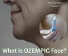 Ozempic Face??