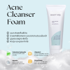 Acne Cleanser Foam