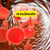 การอักเสบ การอักเสบ