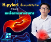 H.pylori เชื้อแบคทีเรียร้าย สาเหตุมะเร็งกระเพาะอาหาร H.pylori เชื้อแบคทีเรียร้าย สาเหตุมะเร็งกระเพาะอาหาร