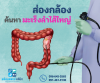 ส่องกล้องค้นหามะเร็งลำไส้ใหญ่ ส่องกล้องค้นหามะเร็งลำไส้ใหญ่
