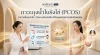 ภาวะถุงน้ำในรังไข่ (PCOS) อาการเป็นอย่างไร | Aesthetaclinic ภาวะถุงน้ำในรังไข่ (PCOS) อาการเป็นอย่างไร | Aesthetaclinic