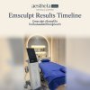 Emsculpt เห็นผลกี่วัน ไทม์ไลน์ผลลัพธ์ที่ควรรู้ก่อนทำ Emsculpt เห็นผลกี่วัน ไทม์ไลน์ผลลัพธ์ที่ควรรู้ก่อนทำ
