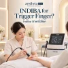 Indiba รักษานิ้วล็อค | Aesthetaclinic Indiba รักษานิ้วล็อค | Aesthetaclinic
