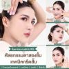 รีวิวตาสองชั้น รีวิวตาสองชั้น