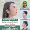 แก้จมูกโอเพ่นไร้ซิลิโคน แก้จมูกโอเพ่นไร้ซิลิโคน