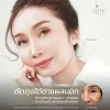 รีวิวตัดถุงใต้ตาแผลนอก