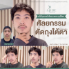 รีวิวตัดถุงใต้ตา โคราช ผู้ชาย