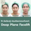 ดึงหน้าชั้นลึก