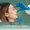 ทำความรู้จักกับการเสริมจมูกแบบ Open คืออะไร? ดีอย่างไร?