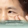 เช็กสาเหตุถุงใต้ตาบวม และวิธีรักษาให้ผิวรอบดวงตากลับมาดูสดใส