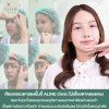 รีวิวตาสองชั้นแก้ไขกล้ามเนื้อตาอ่อนแรง