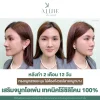 เสริมจมูกแบบโอเพ่น โคราช เสริมจมูกแบบโอเพ่น โคราช