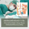 ดึงหน้าชั้นลึก deep plane facelift aline clinic โคราช ดึงหน้าชั้นลึก deep plane facelift aline clinic โคราช