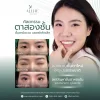 รีวิวทำตาสองชั้น โคราช แก้ปัญหาตาหลบใน โดย ALINE Clinic
