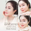ยกคิ้วส่องกล้อง endo brow lift ยกคิ้วส่องกล้อง endo brow lift