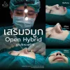 เสริมจมูกโอเพ่น open hybrid
