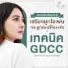 เสริมจมูกโอเพ่น เสริมจมูกโอเพ่น