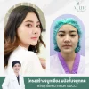 แก้จมูกโอเพ่น แก้จมูกโอเพ่น