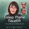 deep plane facelift deep plane facelift