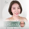 เสริมขมับ-ซิลิโคน-ราคา-รีวิว-aline-clinic เสริมขมับ-ซิลิโคน-ราคา-รีวิว-aline-clinic