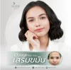 เสริมขมับ-ซิลิโคน-ราคา-รีวิว-aline-clinic เสริมขมับ-ซิลิโคน-ราคา-รีวิว-aline-clinic