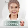 เสริมขมับ-ซิลิโคน-ราคา-รีวิว-aline-clinic เสริมขมับ-ซิลิโคน-ราคา-รีวิว-aline-clinic
