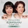 รีวิวตัดถุงใต้ตาแผลนอก aline clinic โคราช รีวิวตัดถุงใต้ตาแผลนอก aline clinic โคราช
