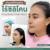 เสริมจมูกโอเพ่น เสริมจมูกโอเพ่น